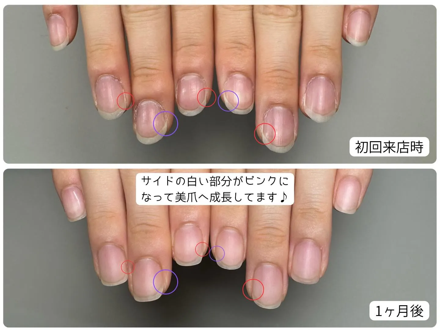 1ヶ月でこの変化👏🏻🩷