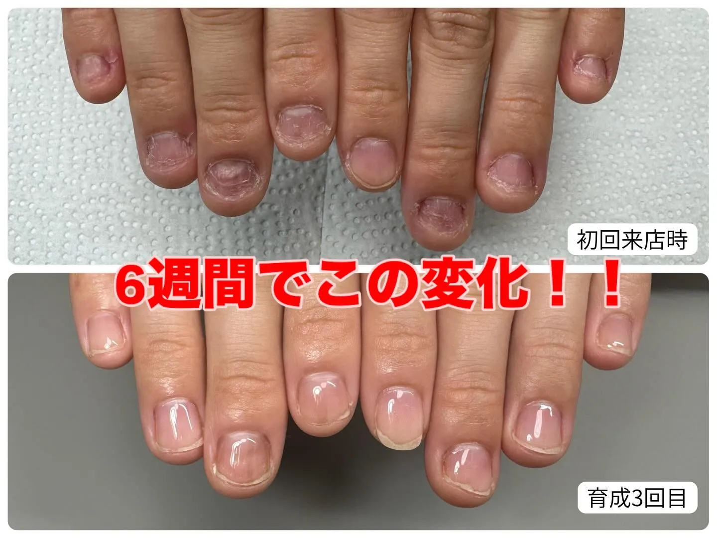 自爪育成記録💅🫧