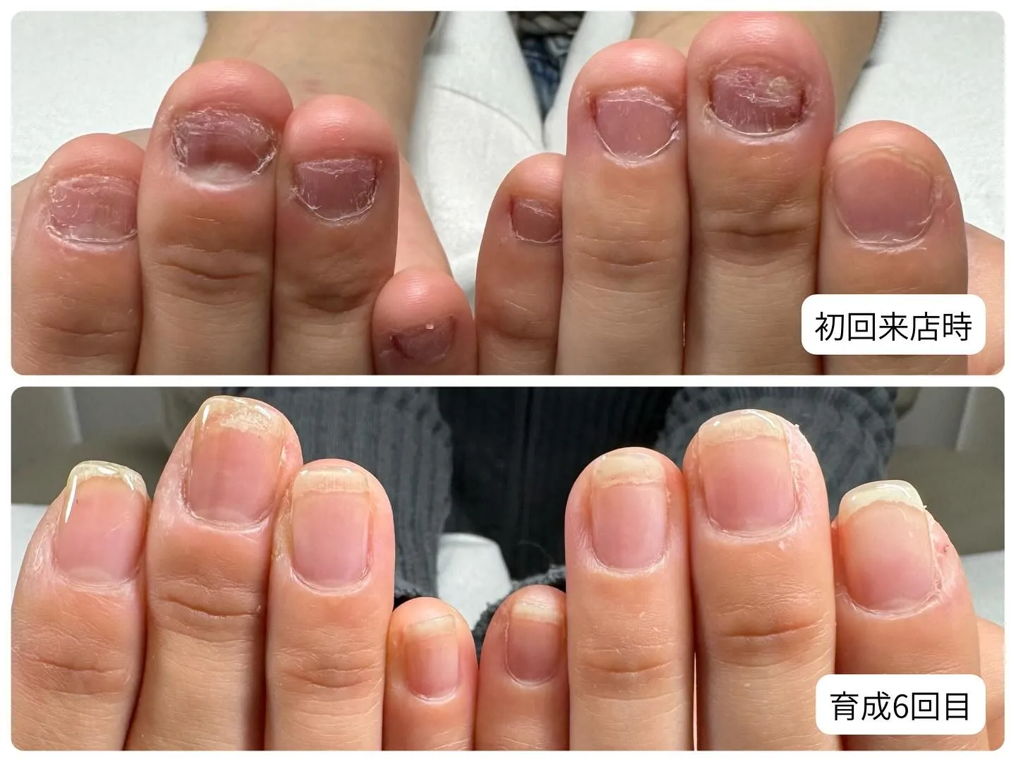 ワンカラー を楽しめるまでに成長しました💅