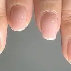 自爪育成