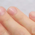 深爪